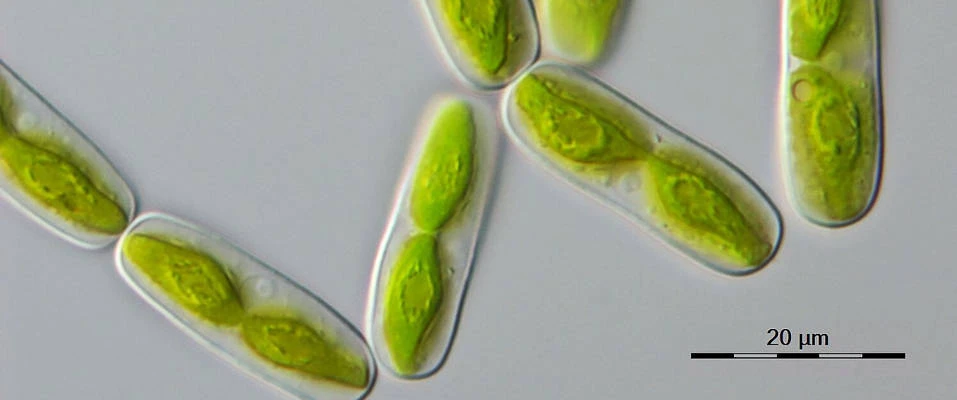 Mikroskopische Aufnahme der einzellige Alge Mesotaenium endlicherianum. Zum Maßstab: 20 Mikrometer entsprechen 0,02 Millimeter Einzellige Alge durch ein Mikroskop betrachtet