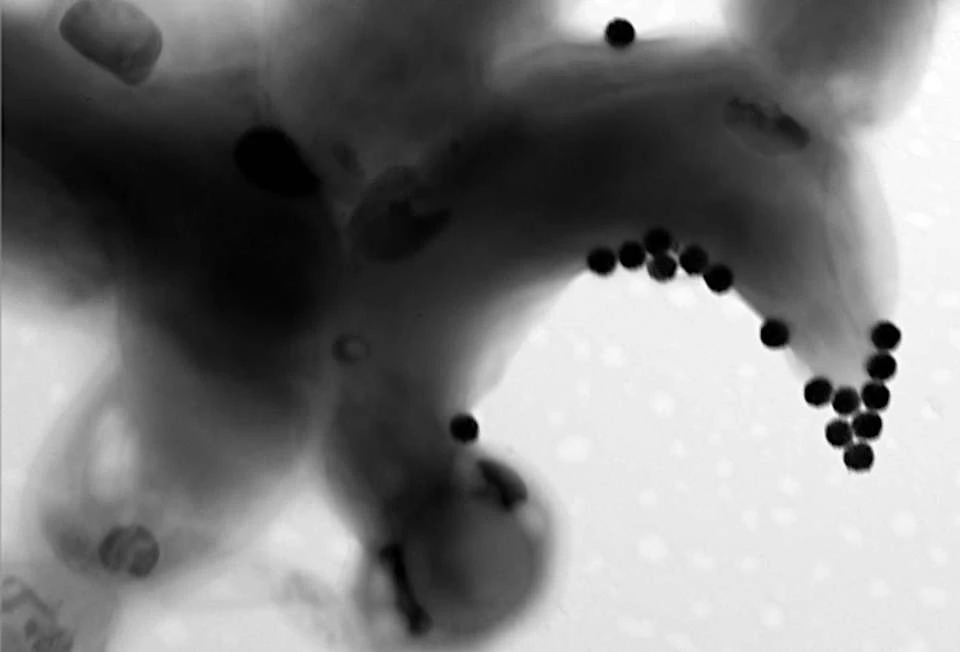 Algenzelle mit Nanoplastik